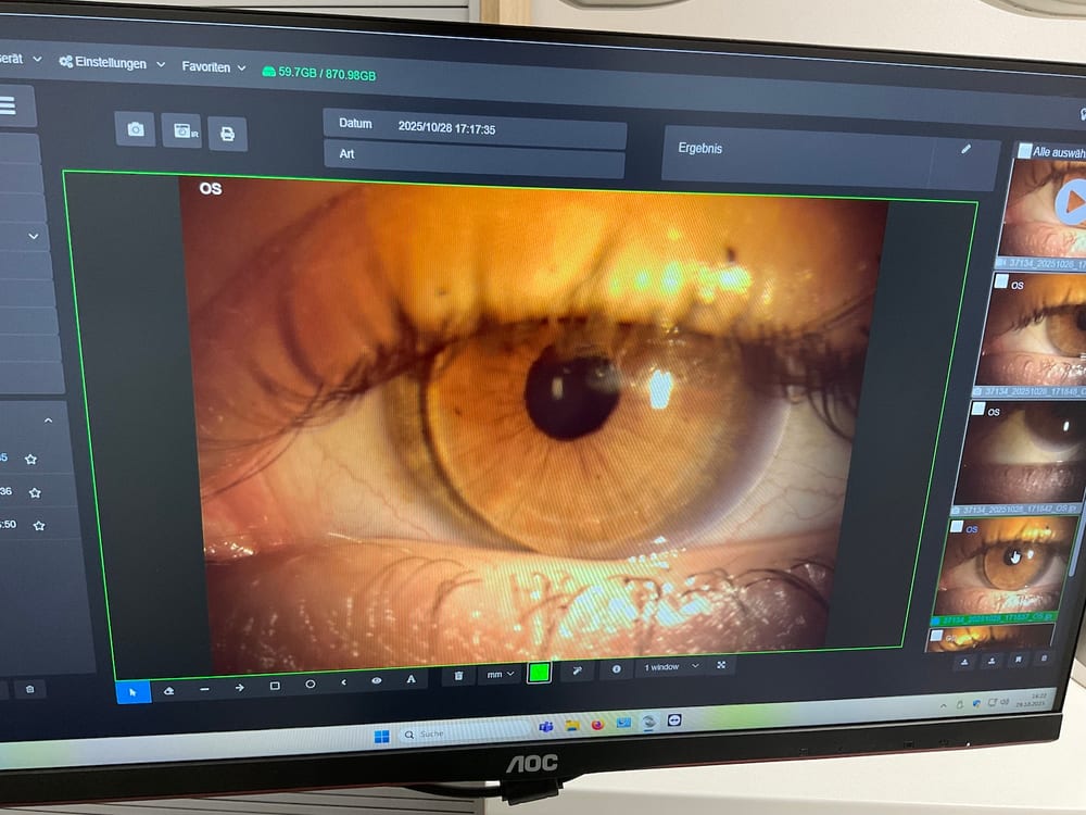 Kontaktlinsenanpassung mit Spaltlampe bei Die Brille Dömer